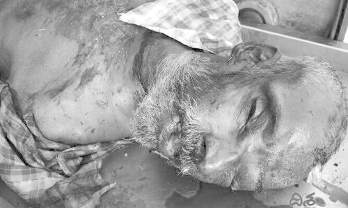 ఆర్టీసీ బస్సు ఢీకొని గుర్తు తెలియని వ్యక్తి మృతి