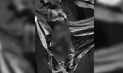 రెండు లారీలు ఢీ.. ఓ వ్యక్తికి తీవ్రగాయాలు