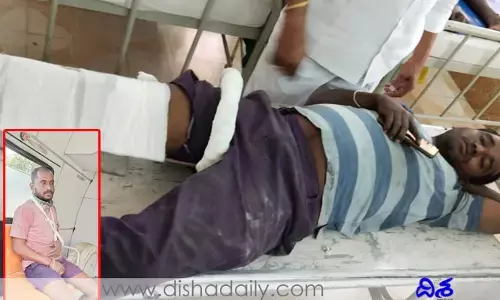 అగని గని ప్రమాదాలు.. ఇద్దరు కార్మికులకు గాయాలు