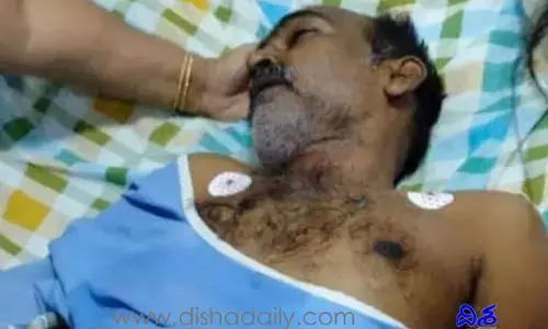 ప్రజా గాయకుడు, డప్పు కళాకారుడు డప్పు రమేశ్ కన్నుమూత