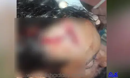 దళితుల మధ్య చిచ్చు పెట్టిన దళిత బంధు
