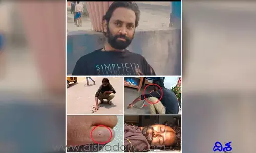 ఎన్నో పాములను రక్షించిన స్నేక్ క్యాచర్.. చివరకు పాముకాటుతోనే..