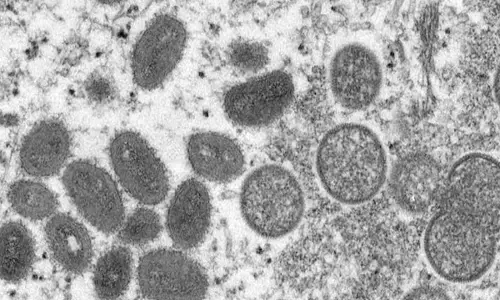 Second Monkeypox Case in India Reported From Kerala