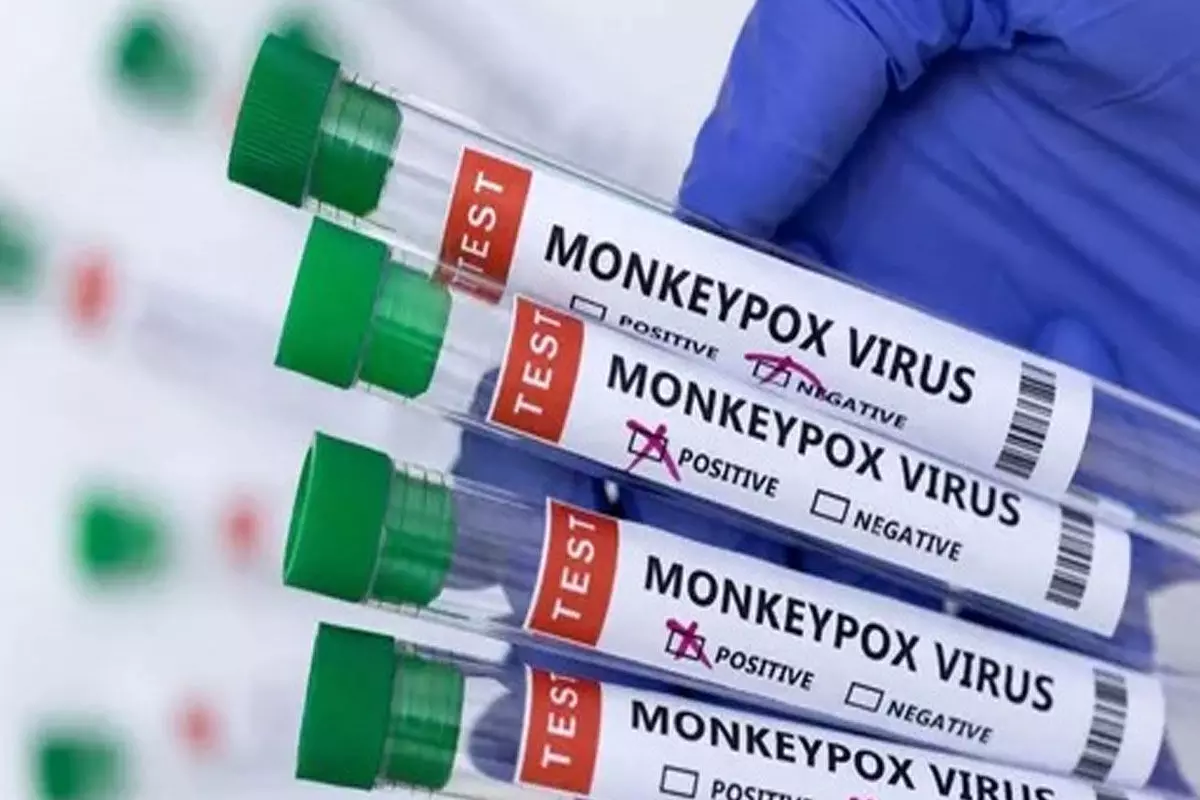 Indias Third Monkeypox Case Registered From Kerala