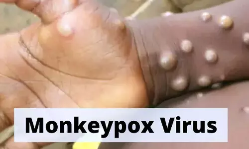 Center Emergency meeting to Contain Spread of Monkeypox Infection