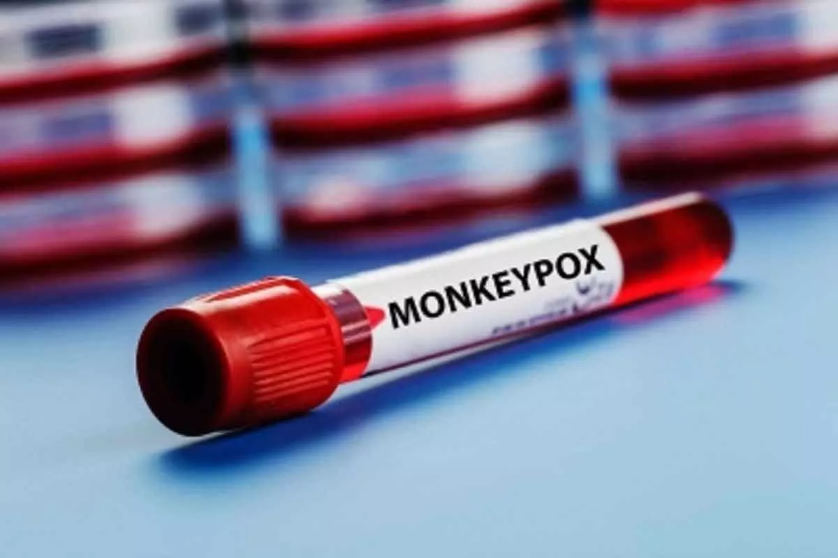 Delhi Reports Indias First Monkeypox Case in a Woman