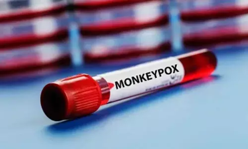 Delhi Reports Indias First Monkeypox Case in a Woman