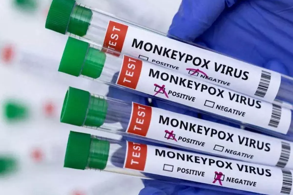 Delhi Reports Fifth Monkeypox Cases Delhi Reports Fifth Monkeypox Cases