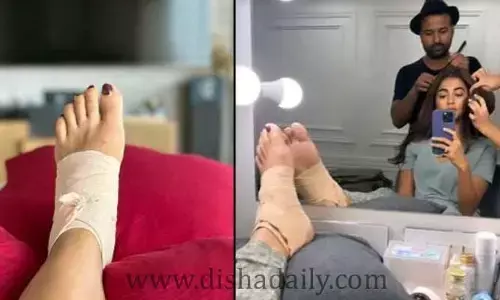 కాలుకు కట్టుతో నడవలేని స్థితిల్లో Pooja Hegde.. అసలేం జరిగింది...?