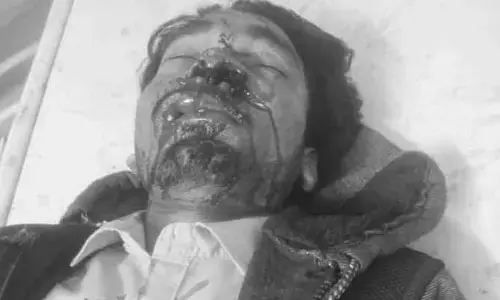 స్కూటీ అదుపు తప్పి యువకుడికి తీవ్ర గాయాలు
