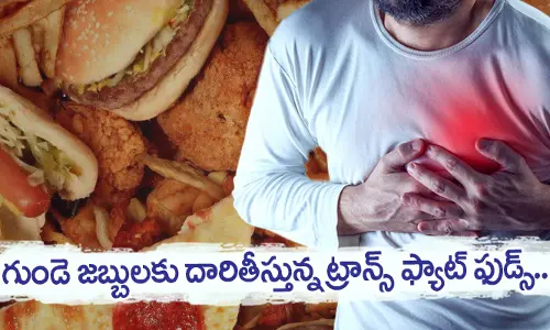 గుండె జబ్బులకు దారితీస్తున్న ట్రాన్స్ ఫ్యాట్ ఫుడ్స్ ! అదెలాగంటే..
