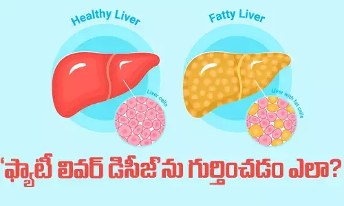 Fatty liver disease : ఫ్యాటీ లివర్ డిసీజ్‌ను గుర్తించడం ఎలా?