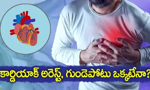 కార్డియాక్ అరెస్ట్, గుండెపోటు ఒక్కటేనా?