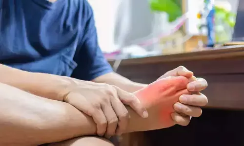 Uric Acid: యూరిక్ యాసిడ్‌ను తగ్గించుకునే .. అద్భుత ఔషధం ఇదే !