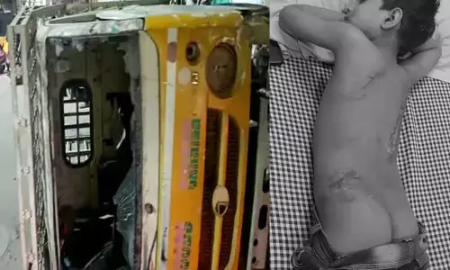 ఆటో ఢీకొనడంతో బాలుడికి తీవ్ర గాయాలు