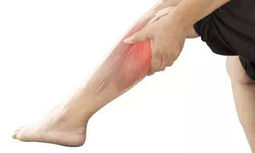 Cramps : కాళ్లు, చేతులు  తిమ్మిర్లకు గురవుతున్నాయా?