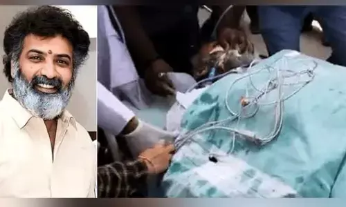 Taraka Ratna Health:అత్యంత విషమంగా తారకరత్న ఆరోగ్యం.. కాసేపట్లో హెల్త్ బులెటిన్