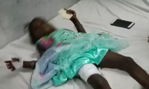 Anantapur: కుక్కర్ పేలి నలుగురు చిన్నారులకు గాయాలు