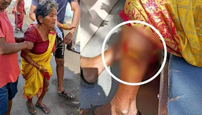 వృద్ధురాలిపై కుక్కల దాడి వృద్ధురాలిపై కుక్కల దాడి