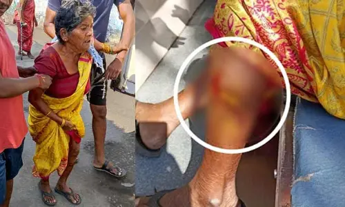 వృద్ధురాలిపై కుక్కల దాడి