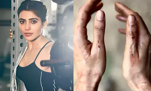 Samantha: గాయపడ్డ సమంత.. రక్తంతో షాకింగ్ పోస్ట్