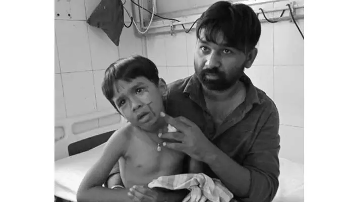 మరో బాలుడిపై కుక్కల దాడి.. మరో బాలుడిపై కుక్కల దాడి..