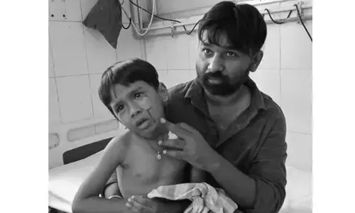 మరో బాలుడిపై కుక్కల దాడి..