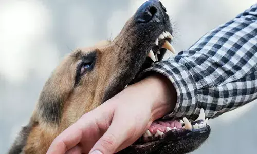 మరోచోట వీధి కుక్కల బీభత్సం.. బాసర MPP భర్తపై దాడి