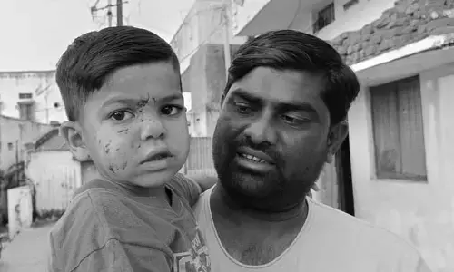 నాలుగేళ్ల బాలుడిపై వీధి కుక్కల దాడి.. తృటిలో తప్పిన ప్రాణాపాయం