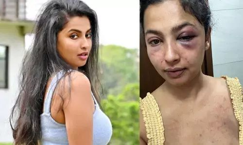 తమిళ నటిపై ప్రియుడి దాడి.. దారుణంగా కొట్టాడంటూ ఫొటోలు పోస్ట్