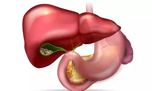 Gall Bladder Stones: గాల్ బ్లాడర్ స్టోన్స్‌‌తో బాధపడుతున్నారా..  తక్షణమే ఈ జాగ్రత్తలు తీసుకోండి