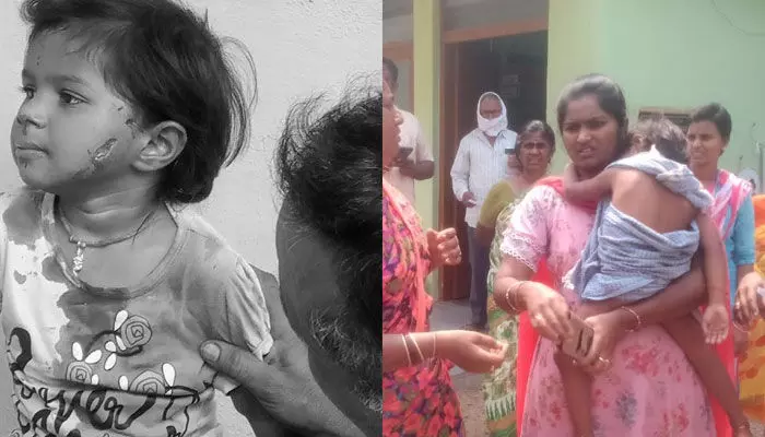 పాపం చిన్నారి.. మూడేళ్ల బాలికపై వీధి కుక్కదాడి పాపం చిన్నారి.. మూడేళ్ల బాలికపై వీధి కుక్కదాడి