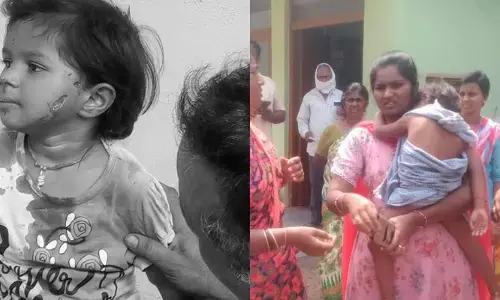 పాపం చిన్నారి.. మూడేళ్ల బాలికపై వీధి కుక్కదాడి