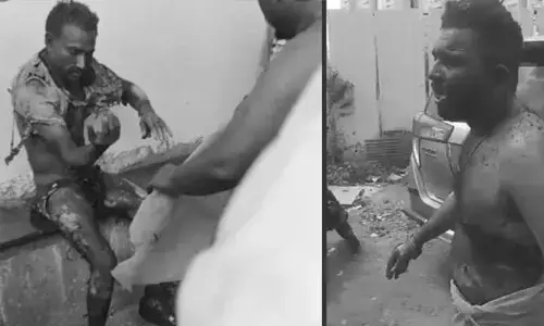 Mangalagiri: ఇద్దరిని ఆస్పత్రి పాలు చేసిన అత్యుత్సాహం