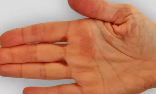 Palmistry: మీ అర చేయి ఎప్పుడైనా రంగు మారిందా?