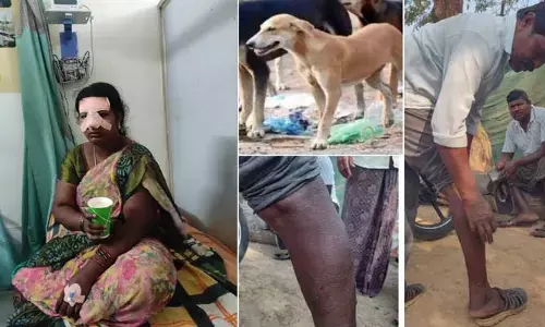 ఎవరైతే మాకేంటి.. పిక్క కనిపిస్తే చాలు కొరికేస్తాం..