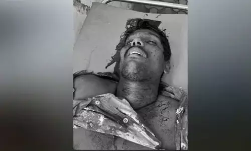 ప్రమాదవశాత్తు కిందపడి వ్యక్తి మృతి..