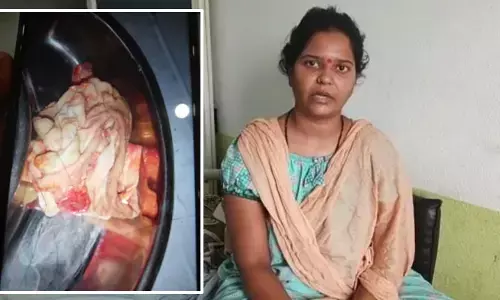 జగిత్యాల ప్రభుత్వాసుపత్రిలో దారుణం.. బాలింత కడుపులో గుడ్డను వదిలి కుట్లు వేసిన వైద్యులు