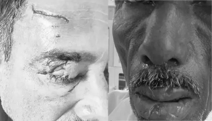 పిచ్చి కుక్కల స్వైర విహారం.. ఏకంగా 10 మందిపై.. పిచ్చి కుక్కల స్వైర విహారం.. ఏకంగా 10 మందిపై..