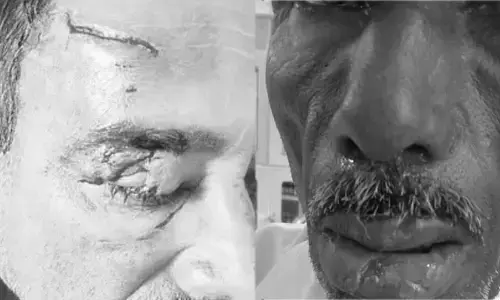 పిచ్చి కుక్కల స్వైర విహారం.. ఏకంగా 10 మందిపై..