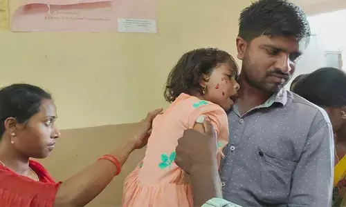 కుక్క దాడిలో నాలుగేళ్ల పాపకు గాయాలు
