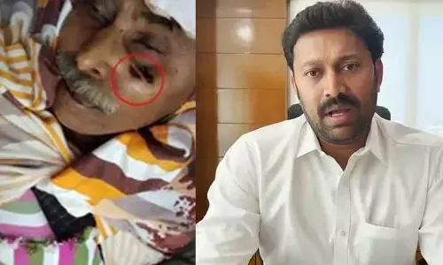 Ts High Court: అవినాశ్‌రెడ్డికి చుక్కెదురు