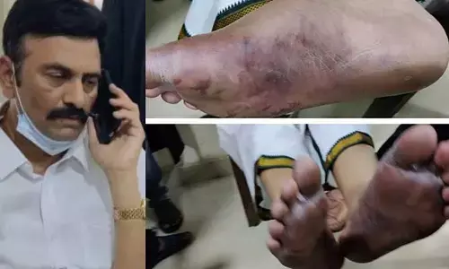 MP Raghurama Case: ఆ కాల్‌ డేటా భద్రపర్చండి.. ప్రభుత్వానికి హైకోర్టు ఆదేశం