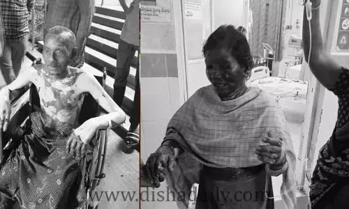 Kadapa: సిలిండర్ పేలి దంపతులకు తీవ్ర గాయాలు