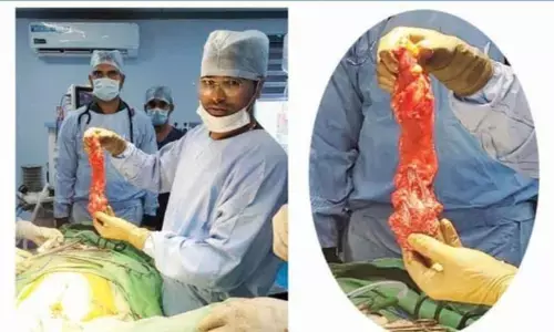 ఆశ ఆసుపత్రిలో అరుదైన శస్త్ర చికిత్స