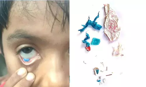 గార్లలో వింత ఘటన.. బాలిక కంట్లో నుంచి ప్లాస్టిక్, ఇనుప ముక్కలు (వీడియో)