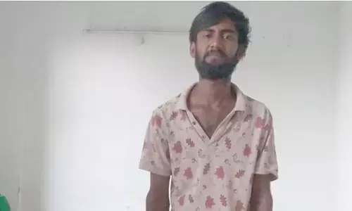 దొరికిపోతానన్న భయంతో గోల్డ్ చైన్ మింగిన దొంగ.. చివరికి ఏమైందంటే?