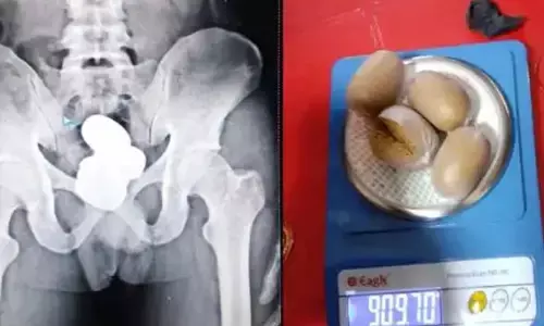 రూ. 86 లక్షల విలువైన బంగారు కడ్డీల పట్టివేత..