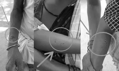 వీధి కుక్క దాడిలో ముగ్గురికి గాయాలు..
