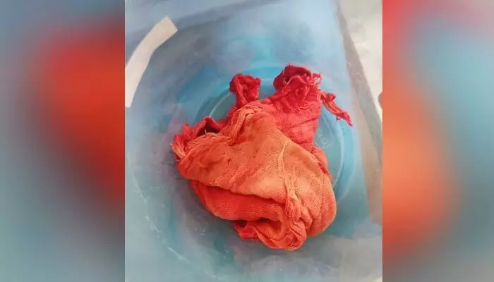 సాయి రక్ష హాస్పిటల్ నిర్వాకం.. మహిళ కడుపులో క్లాత్ మర్చిపోయిన డాక్టర్లు సాయి రక్ష హాస్పిటల్ నిర్వాకం.. మహిళ కడుపులో క్లాత్ మర్చిపోయిన డాక్టర్లు